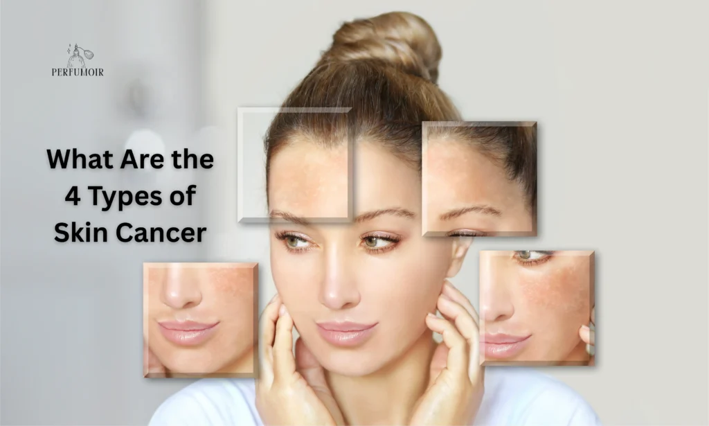 What Are the 4 Types of Skin Cancer